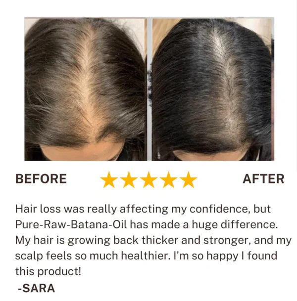 Batana Hair Growth Oil