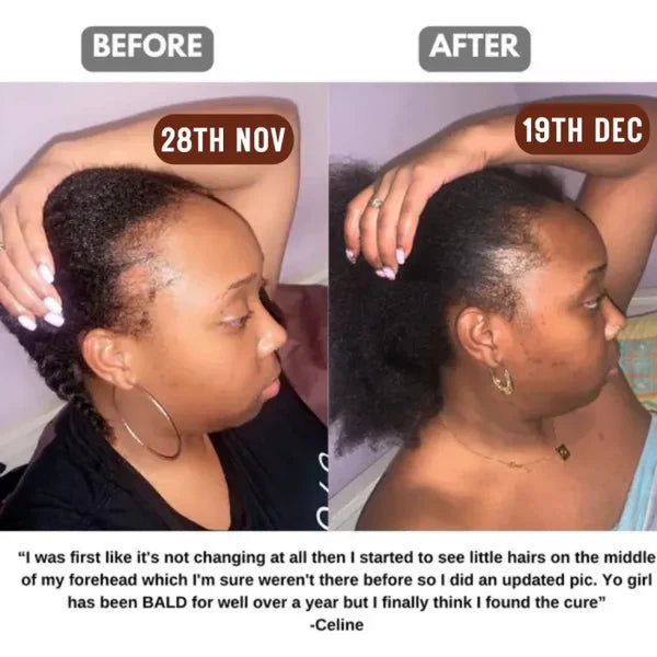 Batana Hair Growth Oil