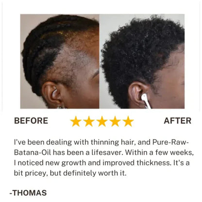Batana Hair Growth Oil