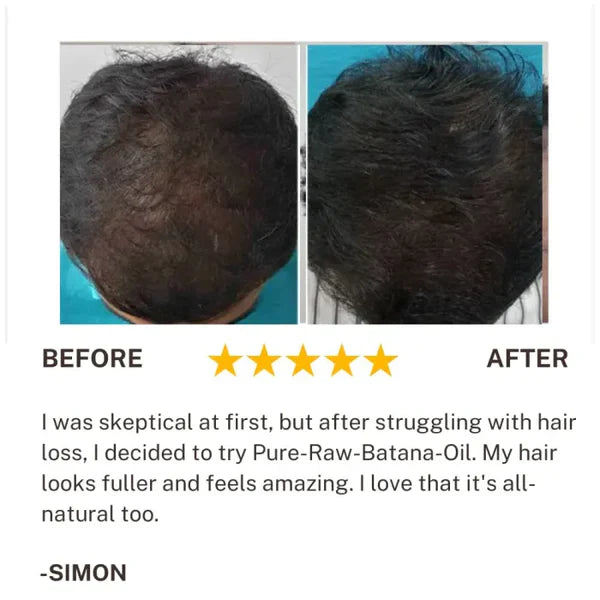 Batana Hair Growth Oil